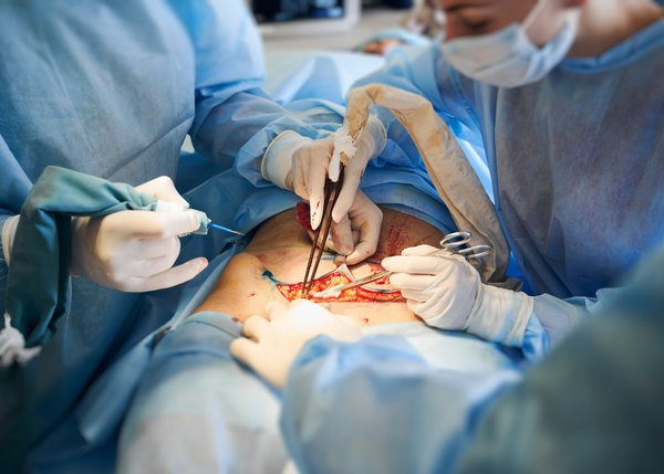 Guide complet de l'abdominoplastie en Tunisie